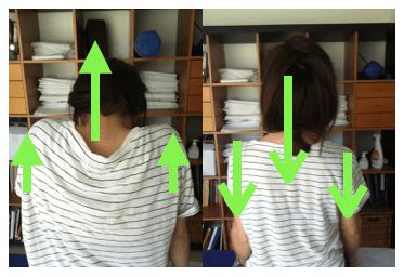 Auto-glissement neural cervical en barbichette bilatérale.png