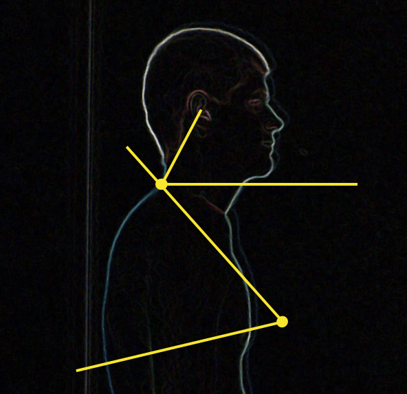 Mesures posture cervico-thoracique