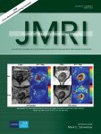 jmri.v49.3.cover