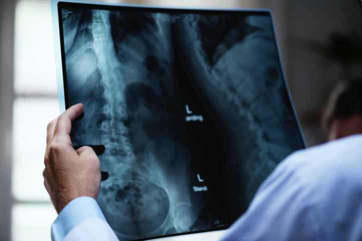 person holding x ray film