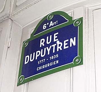 dupuytren