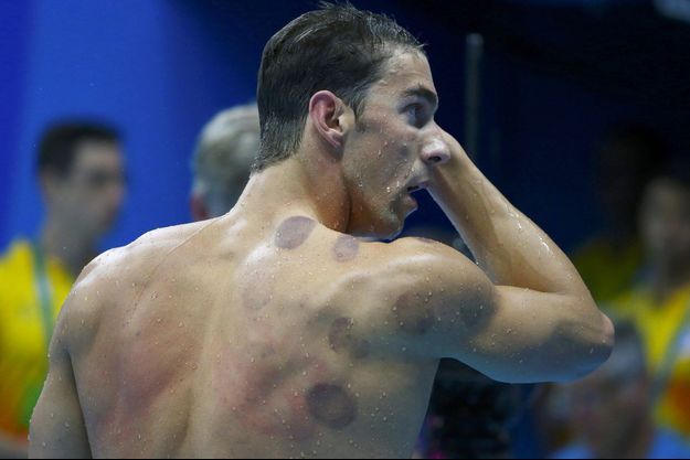 JO-2016-Quelles-sont-les-marques-sur-le-corps-de-Michael-Phelps