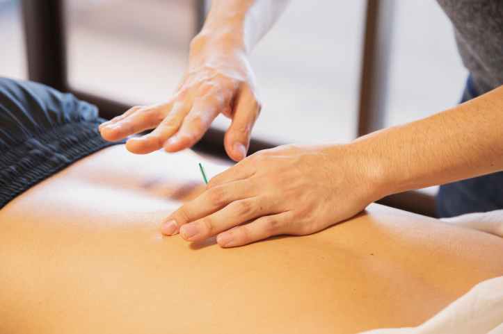 therapeute piquant la peau avec des aiguilles pendant la procedure de traitement